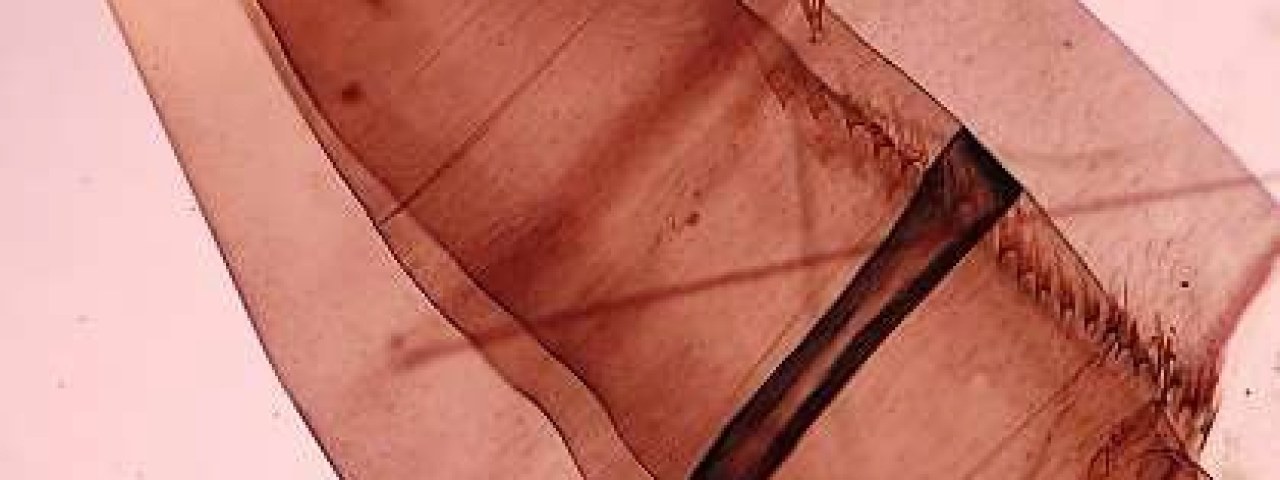 Sanidad informa de la detección de mosquitos de la especie Aedes aegypti en Gran Canaria